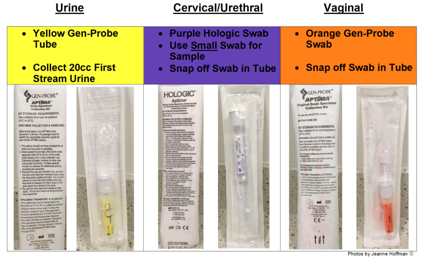 Gonorrhea Chlamydia Testing UCSF